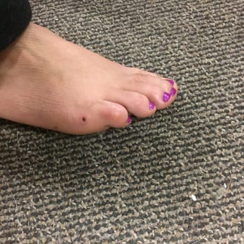 Saloni Nails & Spa - This is the chunk she took out of my foot. It still hurts the next day. - Nail Salons Near Me - Ferndale, Washington Saloni Nails & Spa - This is the chunk she took out of my foot. It still hurts the next day. - Nail Salons Near Me - Ferndale, Washington