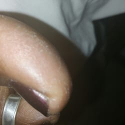Regal Nails, Salon & Spa - Dry skin. This is after the "Deluxe Pedicure"