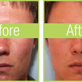Cryocareusa - CryoFacial & Celluma Therapy - Medical Spas Near Me - Laguna Beach, California Cryocareusa - CryoFacial & Celluma Therapy - Medical Spas Near Me - Laguna Beach, California