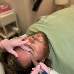 Nicoletta Esthetics - Nano Facial