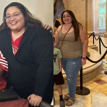 Obesity Relieve - Surgeons Near Me - Tijuana, BCN