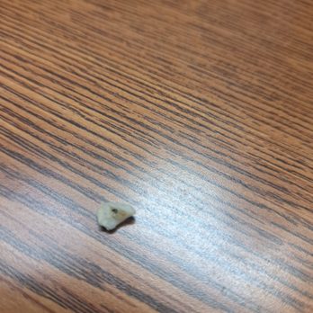 Jackie Chan Chinese Kitchen - piece of tooth that was in my eggroll - Caterers Near Me - Westminster, Colorado