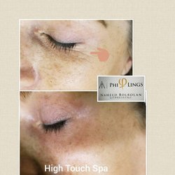 High Touch Spa And Boutique - Wrinkle is what you don't want, but if you get some do not worry about it any more because HIGH TOUCH SPA has the solution Ph...
