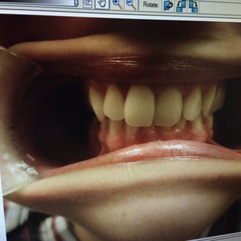 Monika Gyulai, DDS - Before - General Dentistry Near Me Monika Gyulai, DDS - Before - General Dentistry Near Me