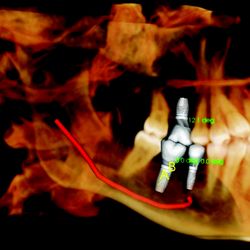 Eric K. Taylor, DDS - 3-D Imaging