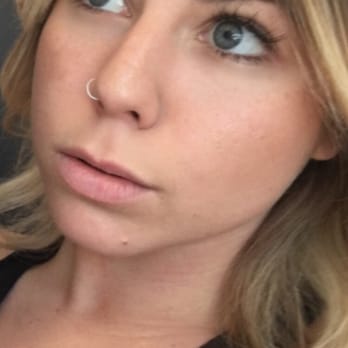 Michael Grossman, MD - Before I came in for juvaderm lip injections. I wanted my upper lip to look more full! - Medical Spas Near Me - Newport Beach, California
