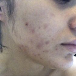 affordable skin care routine watsons