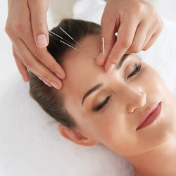 KAM Medical Acupuncture
