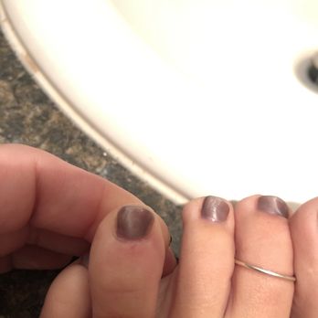 Marvelous Nails - Cuts on my toes - Nail Salons Near Me - Pleasanton, California Marvelous Nails - Cuts on my toes - Nail Salons Near Me - Pleasanton, California