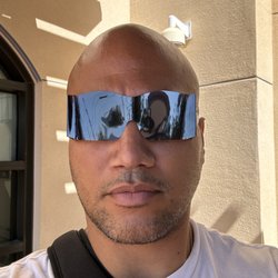 Valley Community Healthcare - Dilated my eyes so my eyes are very sensitive