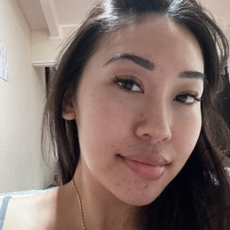Post PCA peel with Minh. Very comfortable process and minimal stinging! Post PCA peel with Minh. Very comfortable process and minimal stinging!