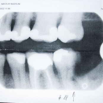 Kleiman Michael DMD - Oral Surgeons Near Me - Edison, New Jersey Kleiman Michael DMD - Oral Surgeons Near Me - Edison, New Jersey
