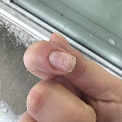 Nice One Nail - Looks like shit!