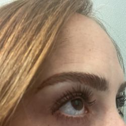Eleven & Rose Aesthetics - Nano fusion touch up