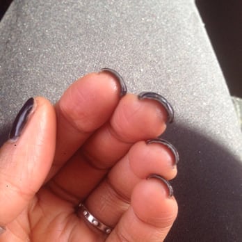 Great Nails & Spa - Clubbed looking fingers. - Nail Salons Near Me - Austin, Texas Great Nails & Spa - Clubbed looking fingers. - Nail Salons Near Me - Austin, Texas