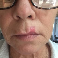 CHARLOTTE SKIN & LASER - 13 Photos & 67 Reviews - Dermatologists - 130