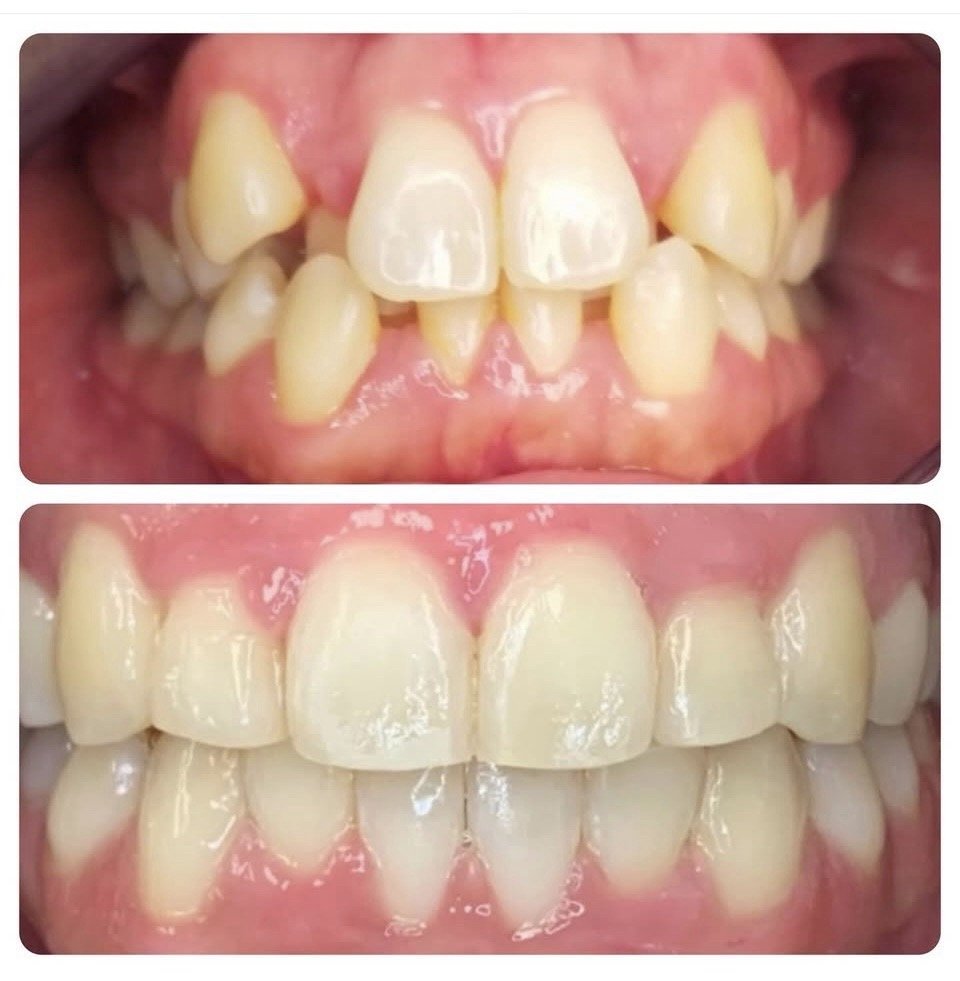 Vancouver Dental Care