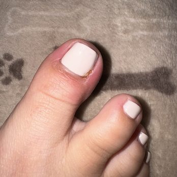 Qtee Nails & Lashes - swollen, redness and nasty stuff - Nail Salons Near Me - San Jose, California Qtee Nails & Lashes - swollen, redness and nasty stuff - Nail Salons Near Me - San Jose, California