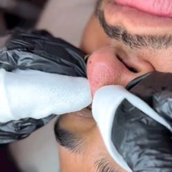 Bloom Wellness - Extractions are included in all facials!
