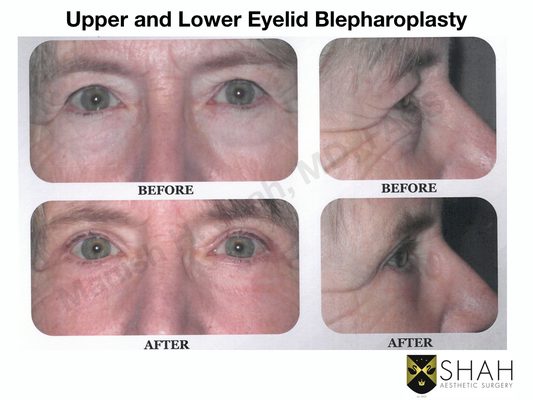 Shah Aesthetic Surgery - Rhinoplasty and Facelift Specialist by null