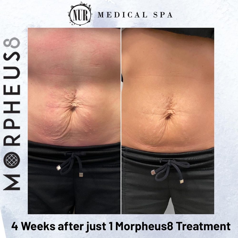 NUR MED SPA Updated August 2024 17 Photos 4309 Blvd