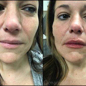 Oceanside Medical - Skin Care Near Me - Warwick, Rhode Island Oceanside Medical - Skin Care Near Me - Warwick, Rhode Island