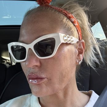 Perfect Dose - Fallon in Vancouver WA fixed my face! - Medical Spas Near Me - Scottsdale, Arizona Perfect Dose - Fallon in Vancouver WA fixed my face! - Medical Spas Near Me - Scottsdale, Arizona