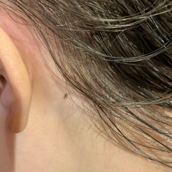 The Lice Queen - Head lice is not usually this easy to spot! - Lice Services Near Me The Lice Queen - Head lice is not usually this easy to spot! - Lice Services Near Me