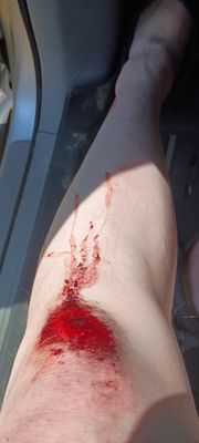 Abbott Northwestern Hospital by null