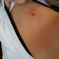 Sundre Golf Club - Direct hit from another tee... ouch