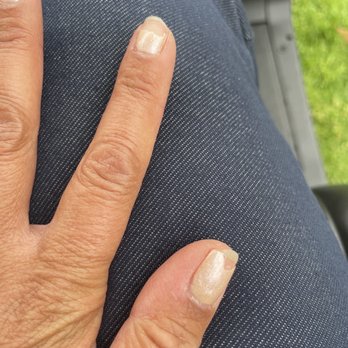 To Nailology - Broken and peeling after four days - Nail Salons Near Me - San Diego, California To Nailology - Broken and peeling after four days - Nail Salons Near Me - San Diego, California