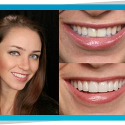 Smile Dental Implants