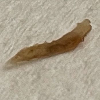 Yi Mei - Unknown pointy sharp object and gross stuff inside the elongated portion found inside the egg daikon cake. - Taiwanese Near Me - San Gabriel, California Yi Mei - Unknown pointy sharp object and gross stuff inside the elongated portion found inside the egg daikon cake. - Taiwanese Near Me - San Gabriel, California