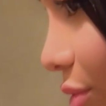 Susan L Chobanian, MD - 4 years after rhinoplasty - Cosmetic Surgeons Near Me - Glendale, California Susan L Chobanian, MD - 4 years after rhinoplasty - Cosmetic Surgeons Near Me - Glendale, California
