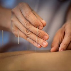 NOVA Chiropractic & Rehab Center of Sterling
