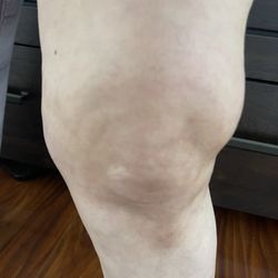 Rehab Access Physical Therapy