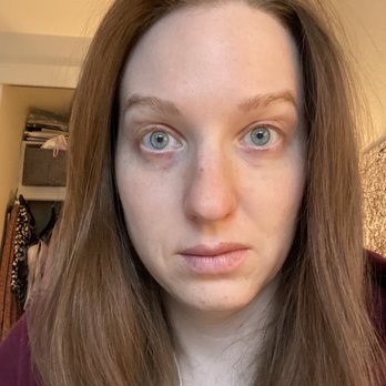 Fresh Faces Rx - Trying to raise eyebrows - Medical Spas Near Me - Portland, Oregon