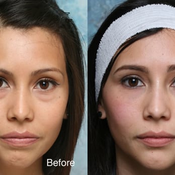 Kenneth D Steinsapir, MD - Cosmetic Surgeons Near Me - Beverly Hills, California