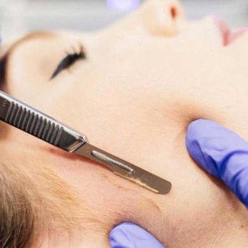 SKIN Day Spa - dermaplaning treatment - Skin Care Near Me - Thousand Oaks, California SKIN Day Spa - dermaplaning treatment - Skin Care Near Me - Thousand Oaks, California