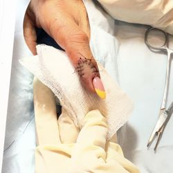 Brazilian Touch MedSpa - Sutures - same day care