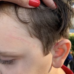 Kool Cuts - This is what they did to my son. As you can see they hurt him in his ear, neck and forehead.