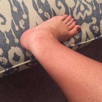 EO Tan and Spa - Same foot, other side. No color on the back of my leg can be seen here. - Spray Tanning Near Me - Riverside, California EO Tan and Spa - Same foot, other side. No color on the back of my leg can be seen here. - Spray Tanning Near Me - Riverside, California