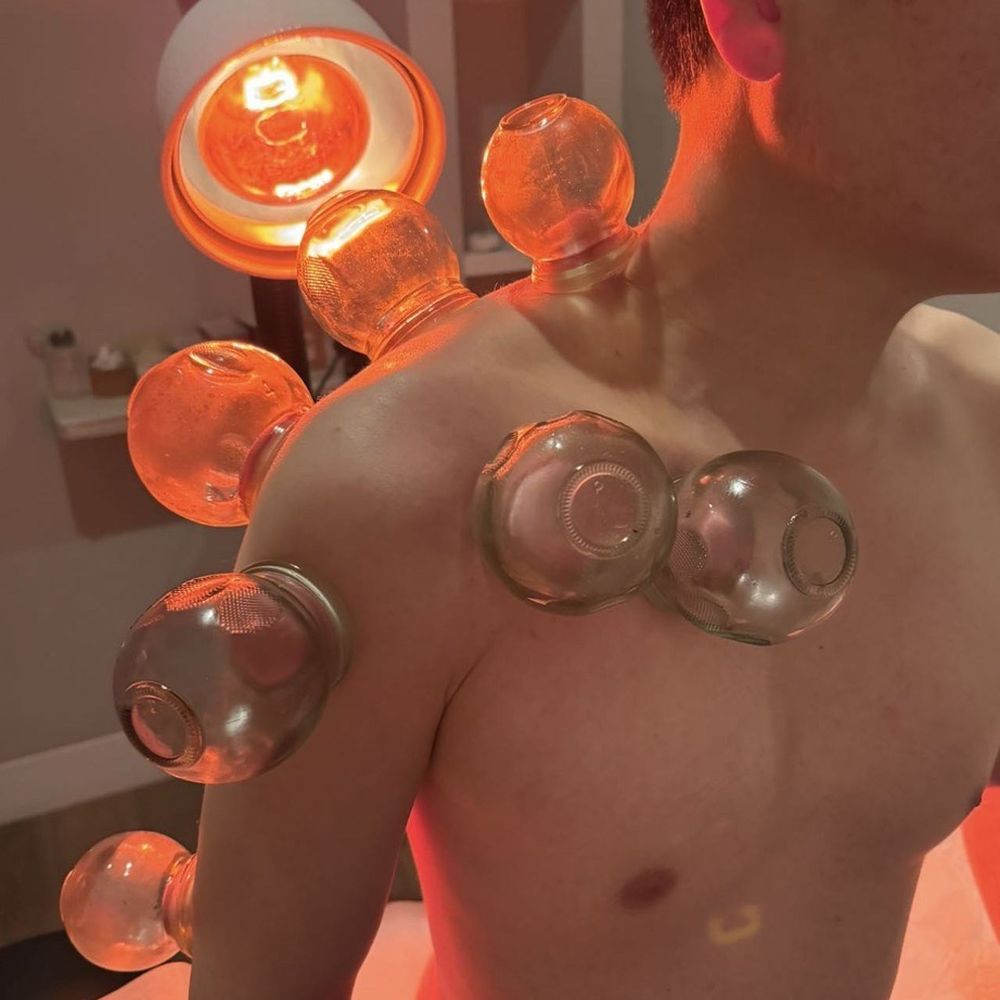 Cupping Cupping