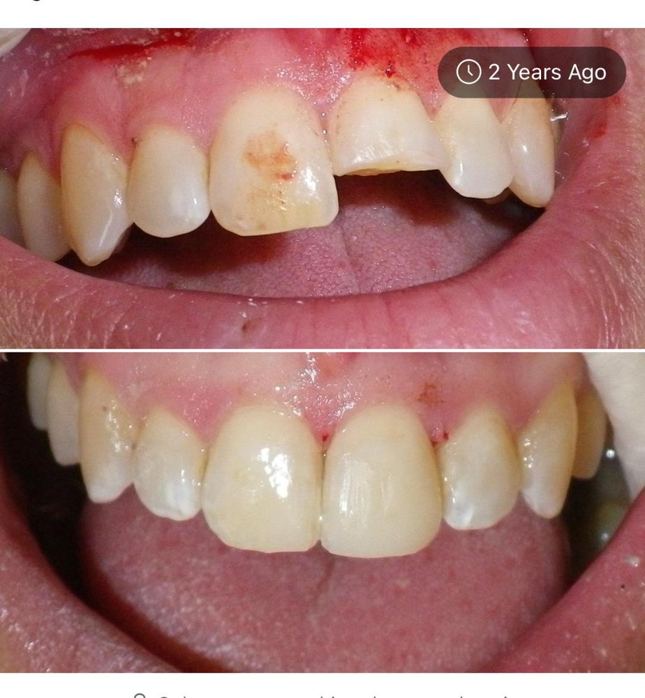 IDEAL DENTAL CARE Updated July 2024 11 Photos 535 Plandome Rd