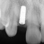 Photo of Anand Maharathi, DMD - El Cerrito-Albany Periodontics