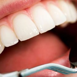 Smile Savvy Dental
