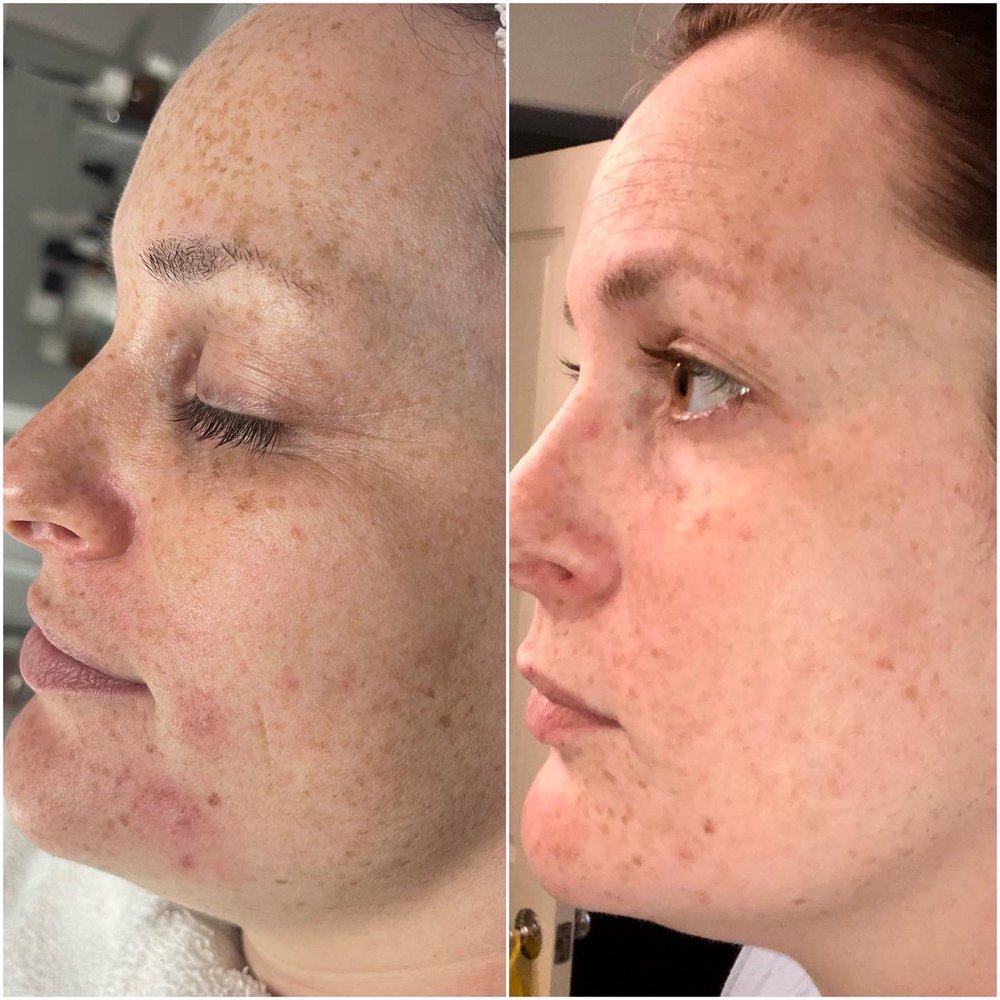 Jackie C skin therapy Logo