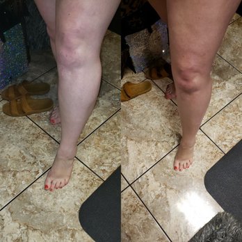 Sunless Bronze - Before & After - Spray Tanning Near Me - Allen, Texas