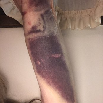 BioLife Plasma Services