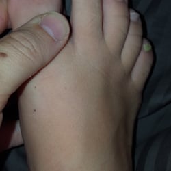 Happy Nails - Notice cut on toe, polish everywhere, all peeled off